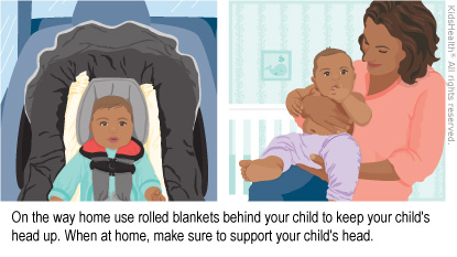 Illustration: Support child's head in car and at home.