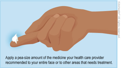 Apply a pea-size amount of the medicine your health care provider recommended to your entire face or to other areas that need treatment.