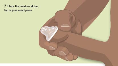 Place the condom at the top of your erect penis.