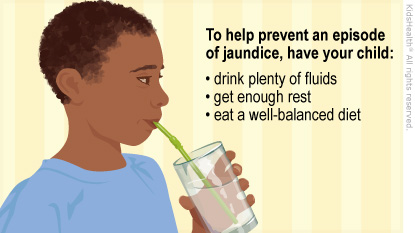To help prevent an episode of jaundice, have your child: drink plenty of fluids, get enough rest, and eat a well-balanced diet.