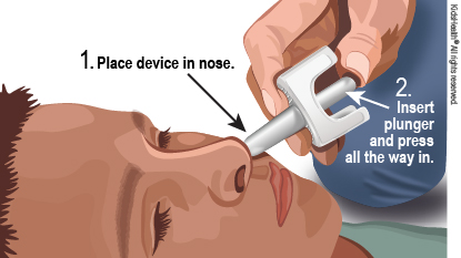 Child lying on back. The tip of a plastic device is placed in the child's nostril. Then the plunger is pushed to deliver the medicine.