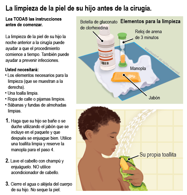 Lea TODAS las instrucciones antes de comenzar.  La limpieza de la piel de su hijo la noche anterior a la cirugía puede ayudar a que el procedimiento comience a tiempo. También puede ayudar a prevenir infecciones. Usted necesitará: • Los elementos necesarios para la limpieza (que se muestran a la derecha). • Una toalla limpia. • Ropa de calle o pijamas limpios. • Sábanas y fundas de almohadas limpias. 1. Haga que su hijo se bañe o se 	     duche utilizando el jabón que se              incluye en el paquete y que           después se enjuague bien. Utilice una toallita limpia y reserve la        manopla para el paso 4.  2. Lave el cabello con champú y enjuáguelo. NO utilice acondicionador de cabello.  3. Cierre el agua o aléjela del cuerpo de su hijo. No seque la piel.
