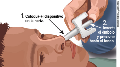 Niño acostado sobre la espalda. La punta del dispositivo de plástico se coloca en el orificio nasal del niño. Después, se presiona el émbolo para administrar el medicamento.